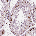 Anti-CTCF Antibody