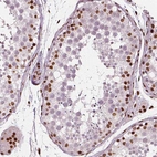 Immunohistochemical staining of human testis shows moderate nuclear positivity in a subset of cells in seminiferous ducts.