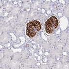 Immunohistochemical staining of human kidney shows strong membranous positivity in cells in glomeruli.