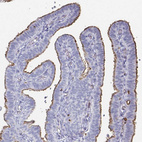 Immunohistochemical staining of human fallopian tube shows moderate positivity in apical membranes of glandular cells.