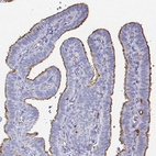 Anti-PODXL Antibody