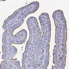 Immunohistochemical staining of human fallopian tube shows moderate positivity in apical membranes of glandular cells.