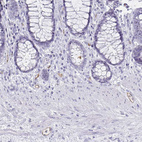 Anti-PODXL Antibody