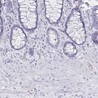 Immunohistochemical staining of human rectum shows weak to moderate membranous positivity in endothelial cells.