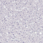Immunohistochemical staining of human liver shows no positivity in hepatocytes as expected.