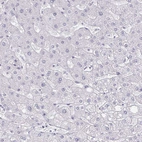 Immunohistochemical staining of human liver shows no positivity in hepatocytes as expected.