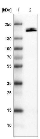 Lane 1: Marker [kDa]_br/_Lane 2: Human kidney tissue lysate