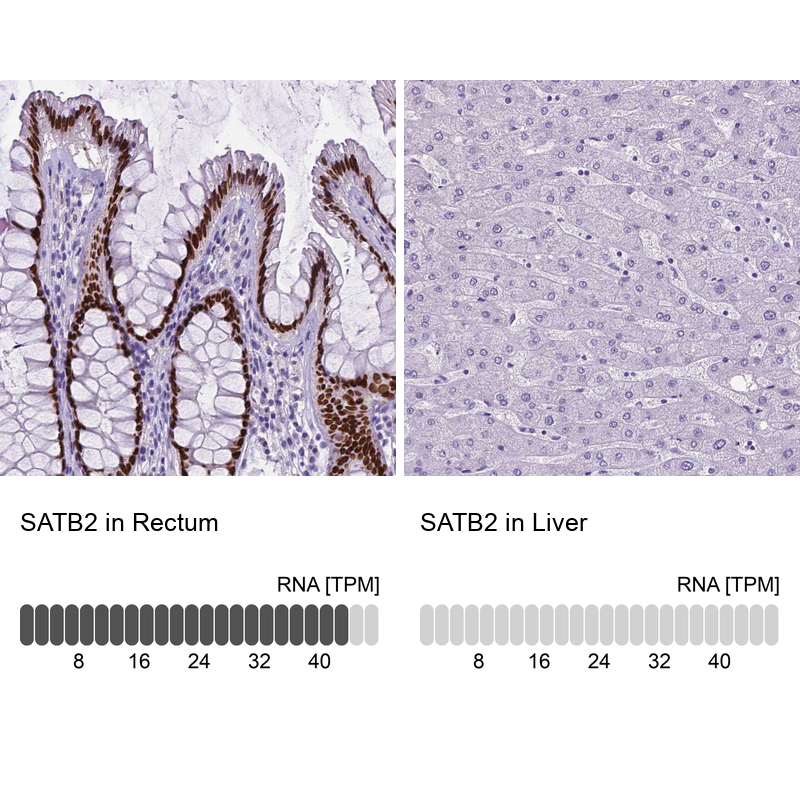 Anti-SATB2 Antibody
