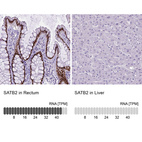 Anti-SATB2 Antibody