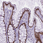 Immunohistochemical staining of human rectum shows strong nuclear positivity in glandular cells.