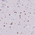 Immunohistochemical staining of human cerebral cortex shows moderate to strong nuclear positivity in neurons.