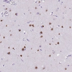 Immunohistochemical staining of human cerebral cortex shows moderate to strong nuclear positivity in neurons.