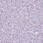 Immunohistochemical staining of human liver shows no nuclear positivity in hepatocytes as expected.