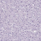 Immunohistochemical staining of human liver shows no nuclear positivity in hepatocytes as expected.