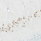 Anti-SATB2 Antibody