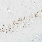Immunohistochemical staining of rat hippocampus shows moderate to strong nuclear positivity in neurons in the CA1 layer.