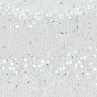 Immunohistochemical staining of rat hippocampus shows no nuclear positivity in neurons in the dentate gyrus as expected.