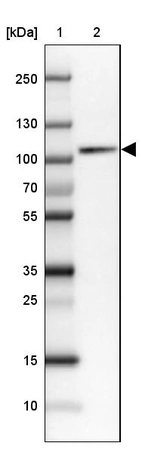 Lane 1: Marker [kDa]_br/_Lane 2: Human cell line HEL