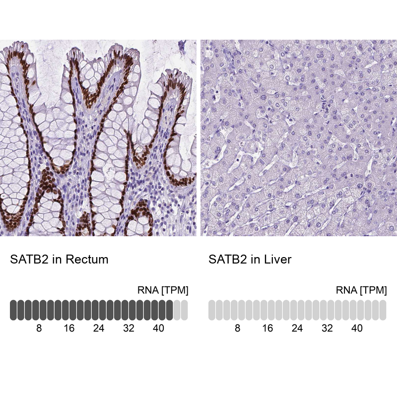 Anti-SATB2 Antibody