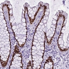 Immunohistochemical staining of human rectum shows strong nuclear positivity in glandular cells.