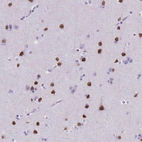 Immunohistochemical staining of human cerebral cortex shows moderate to strong nuclear positivity in neurons.