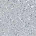 Anti-SATB2 Antibody