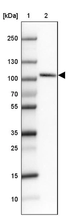 Lane 1: Marker [kDa]_br/_Lane 2: Human cell line HEL