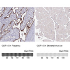 Anti-GDF15 Antibody