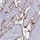Immunohistochemical staining of human placenta shows moderate granular cytoplasmic positivity in trophoblastic cells.