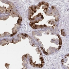 Immunohistochemical staining of human prostate shows strong granular cytoplasmic positivity in a subset of glandular cells.