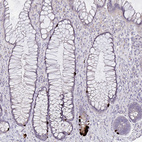 Anti-GDF15 Antibody