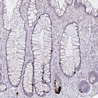 Immunohistochemical staining of human rectum shows strong cytoplasmic positivity in enteroendocrine cells.