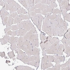 Immunohistochemical staining of human skeletal muscle shows no positivity in myocytes as expected.