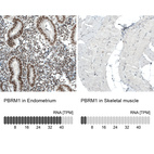 Anti-PBRM1 Antibody