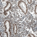 Immunohistochemical staining of human endometrium shows strong nuclear positivity in glandular and stromal cells.