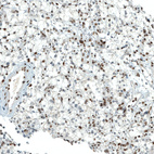 Anti-PBRM1 Antibody