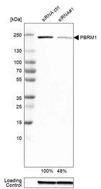 Western blot analysis in RT-4 cells transfected with control siRNA, target specific siRNA probe #1, using Anti-PBRM1 antibody. Remaining relative intensity is presented. Loading control: Anti-GAPDH.