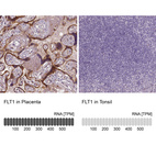 Anti-FLT1 Antibody