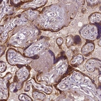 Immunohistochemical staining of human placenta shows strong cytoplasmic positivity in trophoblastic cells.