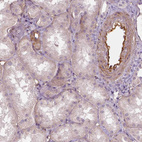 Anti-FLT1 Antibody