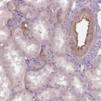 Immunohistochemical staining of human kidney shows strong cytoplasmic positivity in endothelial cells.