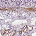 Immunohistochemical staining of human small intestine shows strong cytoplasmic positivity in endothelial cells, as well as positivity in smooth muscle.
