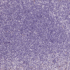Immunohistochemical staining of human tonsil shows no cytoplasmic positivity in lymphoid cells as expected.