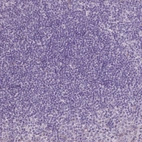 Immunohistochemical staining of human tonsil shows no cytoplasmic positivity in lymphoid cells as expected.