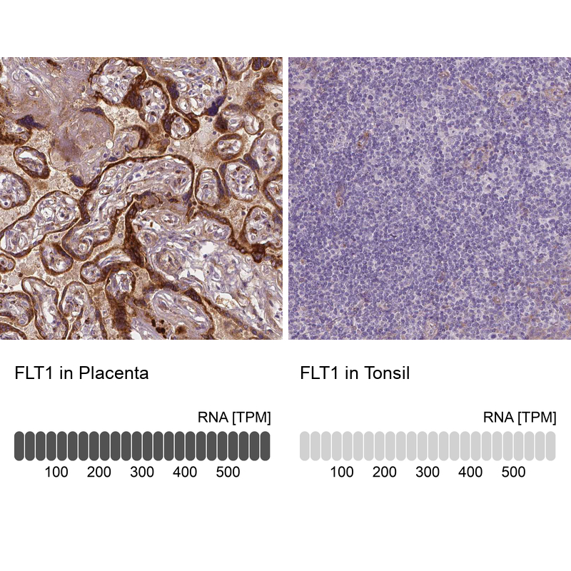 Anti-FLT1 Antibody
