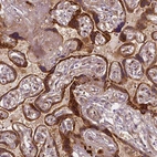 Immunohistochemical staining of human placenta shows strong cytoplasmic positivity in trophoblastic cells.
