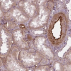 Immunohistochemical staining of human kidney shows strong cytoplasmic positivity in endothelial cells.