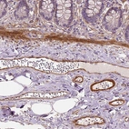 Immunohistochemical staining of human small intestine shows moderate to strong cytoplasmic positivity in endothelial cells, as well as positivity in smooth muscle cells.