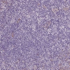 Immunohistochemical staining of human tonsil shows no positivity in lymphoid cells as expected.