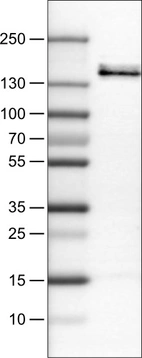 Lane 1: Marker [kDa]_br/_Lane 2: Human cell line RT-4